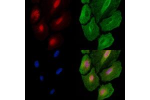 ABIN6260038 and ABIN6278666 staining  cells by IF/ICC. (ARID1A anticorps  (Internal Region))