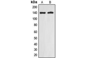 Western blot analysis of EIF5B expression in A549 (A), Jurkat (B) whole cell lysates. (EIF5B anticorps  (C-Term))
