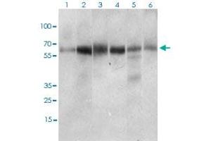 Western blot analysis of Lane 1: Hela cell lysate; Lane 2: Jurkat cell lysate; Lane 3: HEK293 cell lysate; Lane 4: A431 cell lysate; Lane 5: HepG2 cell lysate; Lane 6: RAJI cell lysate with CTNNBL1 monoclonal antibody, clone 1E4F5  at 1:500-1:2000 dilution. (CTNNBL1 anticorps  (AA 390-557))