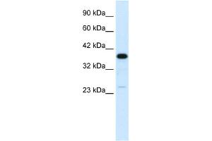 WB Suggested Anti-C4BPB Antibody Titration:  0. (C4BPB anticorps  (N-Term))