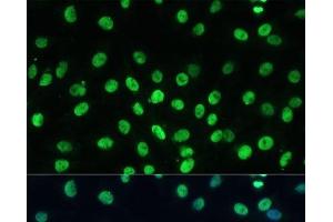 Immunofluorescence analysis of C6 cells using TRIM28 Polyclonal Antibody at dilution of 1:100 (40x lens).
