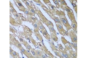 Immunohistochemistry of paraffin-embedded Human liver using CAD Polyclonal Antibody at dilution of 1:100 (40x lens).