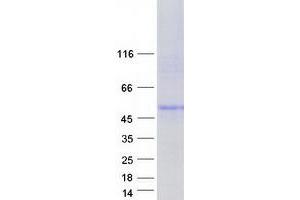 Validation with Western Blot