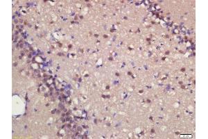 Formalin-fixed and paraffin embedded rat brain labeled with Rabbit Anti-MASH1 Polyclonal Antibody, Unconjugated  at 1:200 followed by conjugation to the secondary antibody and DAB staining