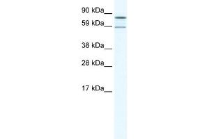 Western Blot showing PARN antibody used at a concentration of 1-2 ug/ml to detect its target protein. (PARN anticorps  (N-Term))