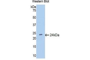 Western blot analysis of the recombinant protein. (IFNA5 anticorps  (AA 22-189))