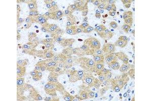 Immunohistochemistry of paraffin-embedded Human liver using NMU Polyclonal Antibody at dilution of 1:100 (40x lens). (Neuromedin U anticorps)