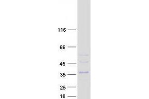 Validation with Western Blot
