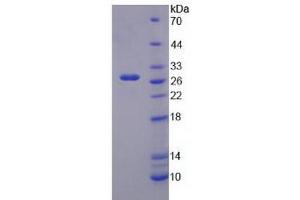 Image no. 1 for Potassium Inwardly-Rectifying Channel, Subfamily J, Member 10 (KCNJ10) (AA 165-379) protein (His tag) (ABIN6237951)
