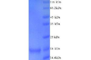 Synuclein, alpha (Non A4 Component of Amyloid Precursor) (SNCA) (AA 1-140), (full length) protein (His tag)