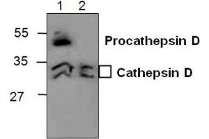 Western blot analysis of Cathepsin D in 3T3 cell lysate (Lane 1) and in Rat kidney tissue lysate (Lane 2). (Cathepsin D anticorps)