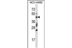 Western blot analysis in NCI-H460 cell line lysates (35ug/lane). (TRIM15 anticorps  (AA 247-276))