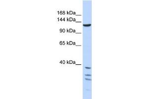 WB Suggested Anti-TNKS Antibody Titration:  1 ug/ml  Positive Control:  721_B cell lysate TNKS is strongly supported by BioGPS gene expression data to be expressed in Human 721_B cells (TNKS anticorps  (Middle Region))