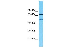 Western Blotting (WB) image for anti-Transmembrane Protein 232 (TMEM232) (N-Term) antibody (ABIN2791955) (TMEM232 anticorps  (N-Term))