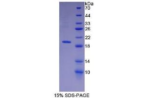 SDS-PAGE (SDS) image for Membrane Metallo-Endopeptidase (MME) (AA 382-538) protein (His tag) (ABIN1099330)