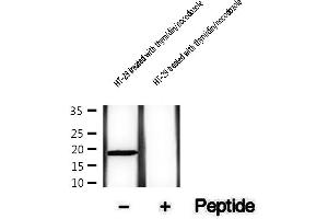 Western blot analysis of extracts of HT-29 cells treated with thymidin/nocodozole, using Phospho-Survivin (Thr34) Antibody . (Survivin anticorps  (pThr34))