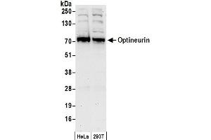 Western Blotting (WB) image for anti-Optineurin (OPTN) (AA 504-554) antibody (ABIN7451913)
