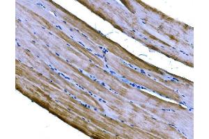 IHC analysis of PKM2 using anti-PKM2 antibody (ABIN3043381). (PKM anticorps  (N-Term))