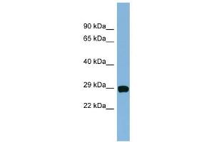 CHCHD3 antibody used at 1 ug/ml to detect target protein. (CHCHD3 anticorps  (N-Term))