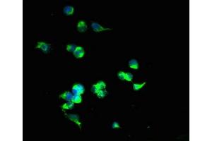 Immunofluorescent analysis of 293T cells using ABIN7170195 at dilution of 1:100 and Alexa Fluor 488-congugated AffiniPure Goat Anti-Rabbit IgG(H+L) (SLC25A4 anticorps  (AA 40-102))