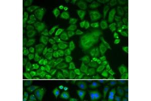 Immunofluorescence analysis of HeLa cells using ACTR3 Polyclonal Antibody (ACTR3 anticorps)