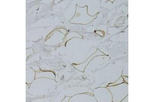 Immunohistochemistry of paraffin-embedded human breast adipocytes using GPD1 Antibody.