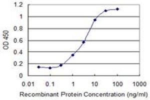 Detection limit for recombinant GST tagged PRKCD is 0. (PKC delta anticorps  (AA 577-676))