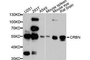 Western blot analysis of extracts of various cell lines, using CRBN antibody. (CRBN anticorps)