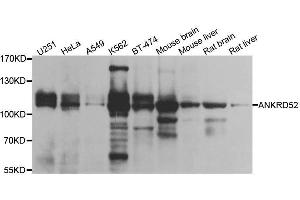 Western blot analysis of extracts of various cell lines, using ANKRD52 antibody. (ANKRD52 anticorps  (AA 450-660))