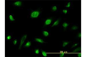 Immunofluorescence of monoclonal antibody to AK1 on HeLa cell.