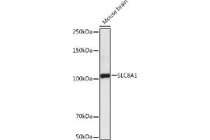 Western blot analysis of extracts of Mouse brain , using SLC8 antibody (ABIN6132664, ABIN6148050, ABIN6148052 and ABIN6221228) at 1:5000 dilution. (SLC8A1 anticorps  (AA 250-520))