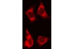 ABIN6266780 staining HeLa cells by IF/ICC. (TNFRSF6B anticorps)