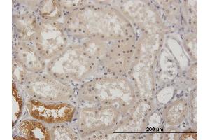 Immunoperoxidase of purified MaxPab antibody to GK on formalin-fixed paraffin-embedded human kidney. (Glycerol Kinase anticorps  (AA 1-524))