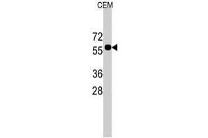Western blot analysis of CNOT4 polyclonal antibody  in CEM cell line lysates (35 ug/lane). (CNOT4 anticorps  (C-Term))