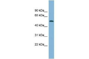 WB Suggested Anti-C2orf29 Antibody Titration: 0. (CNOT11 anticorps  (N-Term))