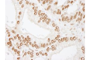 Immunohistochemistry (IHC) image for anti-cAMP Responsive Element Binding Protein 1 (CREB1) (AA 250-300) antibody (ABIN7448947)