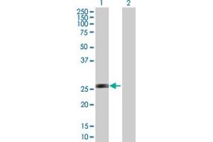 Western Blot analysis of AK3 expression in transfected 293T cell line by AK3 MaxPab polyclonal antibody.