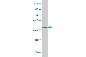 Western Blot detection against Immunogen (34. (HAND2 anticorps  (AA 135-216))