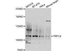 Western blot analysis of extracts of various cell lines, using TRPC4 antibody.