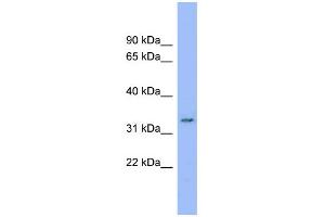 WB Suggested Anti-C20orf116 Antibody Titration:  0. (DDRGK1 anticorps  (Middle Region))