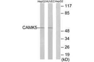 Western blot analysis of extracts from HepG2/HuvEc cells, using CAMK5 Antibody. (CAMKV anticorps  (AA 211-260))