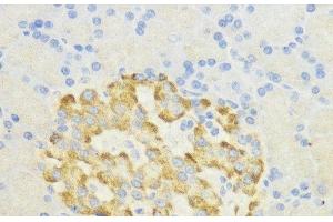Immunohistochemistry of paraffin-embedded Rat pancreatic islet using SURF4 Polyclonal Antibody at dilution of 1:200 (40x lens). (Surfeit 4 anticorps)