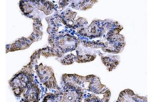 IHC analysis of Tspan-8/Tspan8 using anti-Tspan-8/Tspan8 antibody (ABIN7599681).