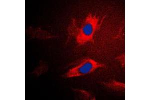 Immunofluorescent analysis of IARS2 staining in Jurkat cells.
