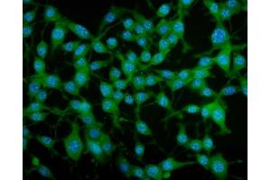 IF analysis of PAR4/Pawr using anti-PAR4/Pawr antibody (ABIN7599938). (PAWR anticorps  (AA 13-333))