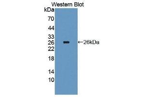 Western Blotting (WB) image for anti-Interleukin 4 Receptor (IL4R) antibody (Biotin) (ABIN1175405)