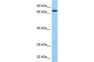 Host:  Rabbit  Target Name:  PTPRN  Sample Tissue:  Human Liver Tumor  Antibody Dilution:  1ug/ml