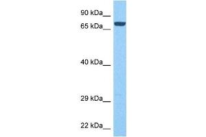 Host:  Rabbit  Target Name:  PTPRN  Sample Tissue:  Human Liver Tumor  Antibody Dilution:  1ug/ml (PTPRN anticorps  (Middle Region))