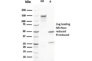 SDS-PAGE Analysis Purified Calretinin Mouse Monoclonal Antibody (CALB2/2602). (Calretinin anticorps  (AA 23-242))