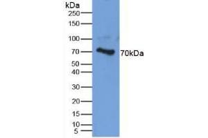 Detection of AGC in Human Cartilage Tissue using Polyclonal Antibody to Aggrecan (AGC) (Aggrecan anticorps  (AA 34-147))